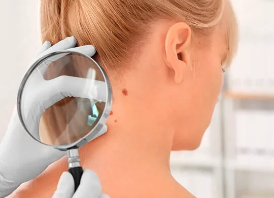 Imagem ilustrativa de avaliação dermatológica da pele