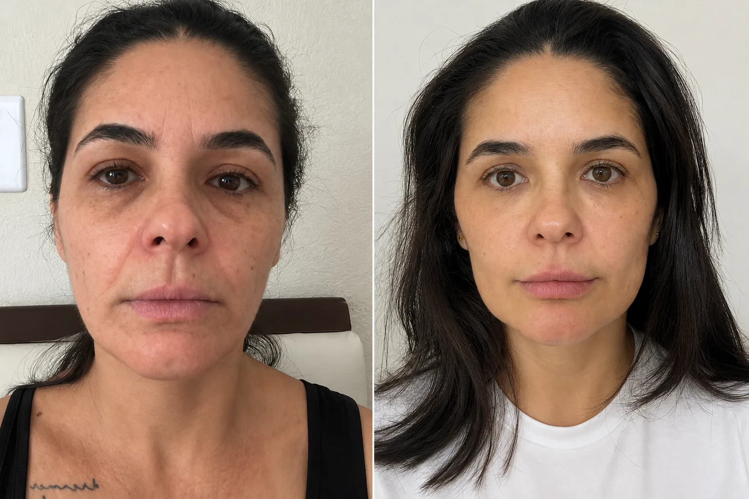 Registro de antes e depois de cuidado estético individualizado no Instituto Helaris